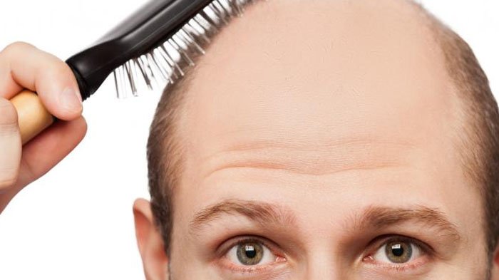 Bahan Tuk Cegah Rambut Rontok Menurut dr Dody Budiarso