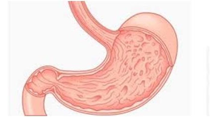 Lambung � Organ Kecil Dengan Kekuatan Super