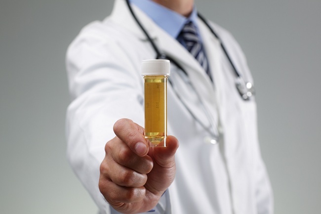 Arti Dibalik Warna Urine Manusia